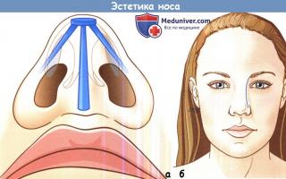 Посттравматическая деформация носа с нарушением функций Чем опасны искривления носовой перегородки